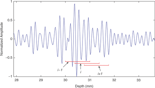 Figure 6. A portion of a normalized RF line and three overlapping windows.