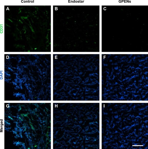 Figure 9 CD31 immunofluorescent staining of tumor sections after 12 days of continuous treatment.Notes: CD31 is a microvascular marker and was stained to evaluate the antiangiogenic effects of different drug treatments. The cD31 expression was shown (A–C) CD31 expression showing green color; (D–F) the nuclear staining DAPI showing blue color; (G–I) merged images of both CD31 and DAPI (scale bar =200 μm, 10×).Abbreviation: GPENs, GX1-conjugated poly(lactic acid) nanoparticles encapsulating Endostar.