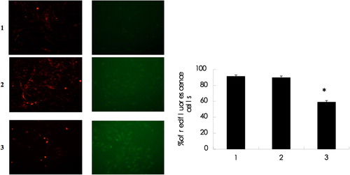 Figure 3. STAT3 siRNA degrades mitochondrial membrane potential in Bel-7402 cells 1: Control group 2: siRNA-scramble group 3: STAT3 siRNA group. The mitochondrial membrane potential with STAT3 siRNA observed by the JC-1 fluorescence staining was significantly decreased when observed under the fluorescence microscope (× 200).
