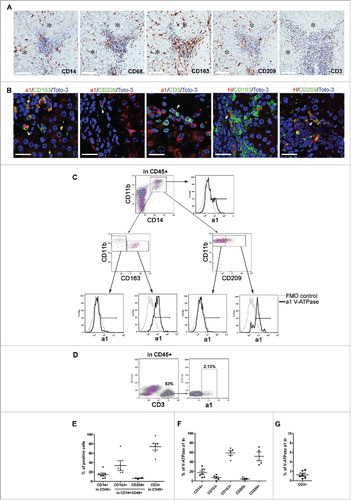 Figure 5. Expression of V-ATPase in immune cells infiltrating HCC tissues. (A) Representative images of immunohistochemical staining for the myeloid-associated markers CD14, CD68, CD163, CD209 and the CD3 T cell marker in HCC tissues. Scale bars = 100 μm are shown. *Identifies the tumor area. (B) Triple-labeled immunofluorescence staining for a1 and H1 subunits of the V-ATPase complex (red) and CD163 (green), CD209 (green) or CD3 (green) in HCC tissues. Nuclei were stained with Toto-3 (blue). White triangles indicate the co-expression of the analyzed markers. Representative images with scale bars = 25 μm. No co-staining was found for CD3 and V-ATPase H1 (data not shown). (C) Multiparametric flow cytometry analysis of live myeloid cells in cell suspensions of freshly dissociated HCC surgical specimens. The CD209 and CD163 positive population has been defined by setting the marker on the corresponding FMO control. The cell surface expression of V-ATPase a1 was evaluated within the CD14+CD11b+, CD11b+CD163−, CD11b+CD163+ CD11b+CD209− and CD11b+CD209+ cell populations and the corresponding histograms are reported (black line). FMO control is shown (gray line). (D) Multiparametric flow cytometry analysis of cell surface V-ATPase a1 expression in live CD3 cells in cell suspensions of freshly dissociated HCC tumors. V-ATPase a1 positive cells have been defined using the FMO control. (E) The graph summarizes the percentages of CD14+, CD163+, CD209+ and CD3+ cells found in the analyzed HCC samples. (F-G) The percentages of V-ATPase a1-positive cells assessed in the indicated myeloid cell populations and within the CD3+ cells for all the analyzed samples.