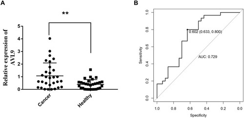 Figure 6 Diagnostic utility of circulating AVL9 was tested in 30 CRC patients and 30 healthy subjects.