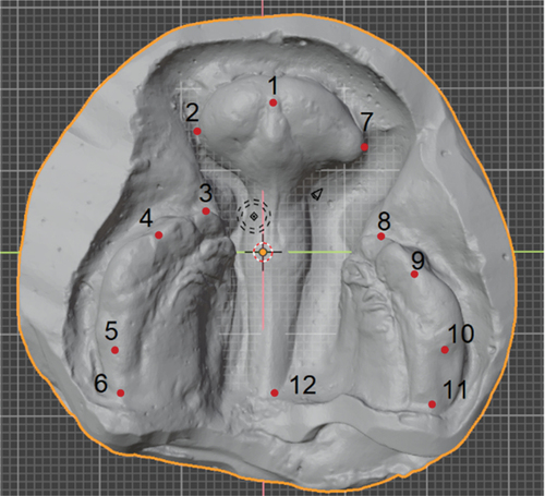 Figure 2. Landmarks of maxillary arch: 1. apex of ridge situated on line demarcating labial frenulum and incisive papilla, 2. rightmost boundary of premaxilla, extending from alveolar ridge, 3. Anterior most point on right maxillary segment, 4. distal boundary of canine protuberance on right maxillary segment, 5. Distal boundary of molar protuberance on right maxillary segment, 6. tuberosity point on right maxillary segment, 7. leftmost boundary of premaxilla, extending from the alveolar ridge, 8. Anterior most point on left maxillary segment, 9. distal boundary of the canine protuberance on the left maxillary segment, 10. distal boundary of molar protuberance on right maxillary segment, 11. Tuberosity point on left maxillary segment, 12. reference point located at base of a perpendicular line drawn from landmark 1 to line connecting segments from reference points 6 and 11.