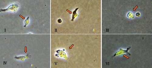 Figure 5. a. Primary peritoneal macrophages phagocytic fluorescent microspheres; b. Phagocytosis of peritoneal macrophages based on fluorescent microspheres imaging. The arrow represents a primary peritoneal macrophage. i. Phagocytosis of a microsphere into a cell; ii. Phagocytosis of two microspheres into a cell; iii. Phagocytosis of three microspheres into a cell; iv. Phagocytosis of four microspheres into a cell; v. Phagocytosis of five microspheres into a cell; and vi. More than six microspheres engulfing a cell.