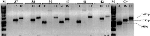 Figure 2 Haptoglobin genotyping by allele-specific PCR. Electrophoresis on 1.5% agarose gel demonstrating genotype identification using DNA from individuals (numbers 37 to 42) representing genotypes Hp 1S-1F, Hp 2-1F and Hp 2-1S. The allele 1F is represented by PCR product of 1,4Kbp (primers F3/C72); 1S by 1,2Kbp (primers C51/S2) and allele 2 by 935bp (primers F3/C42). M represents the size marker GeneRuller 1Kb (Thermo Scientific) and C+: are positive amplicons for each allele.Notes: F3, C72, C51, S2 and C42 are primers name (Table 1). 1S: alpha 1 chain Slow – HP1 allele; 1F: alpha 1 chain Fast – HP1 allele; 2: alpha 2 chain – HP2 allele; Kbp: Kilobase pairs; bp: base pairs. Copyright ©1998. Acta Medica Okayama (Japan). Reproduced from Yano A, Yamamoto Y, Miyaishi S, Ishizu H. Haptoglobin genotyping by allele-specific polymerase chain reaction amplification. Acta Med Okayama. 1998;52:173–181.Citation19