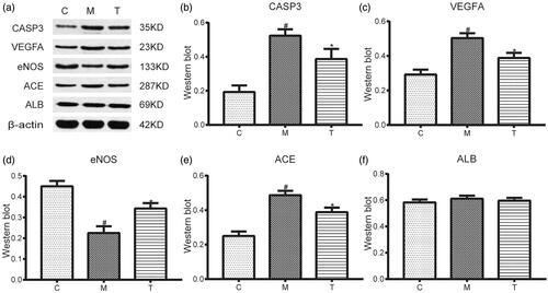 Figure 6. (a) Electrophoretogram of five proteins (CASP3, VEGFA, eNOS, ACE, and ALB) in rats from the C, M, and T groups. (b–f) The expression levels of five proteins (CASP3, VEGFA, eNOS, ACE, and ALB) in rats from the C, M, and T groups were determined using western blotting. Data are expressed as the mean ± SEM. Independent sample t-tests were employed for comparison between the two groups. Differences with p < 0.05 were considered statistically significant. #p < 0.05, the M group vs. the C group; *p < 0.05, the T group vs. the M group.