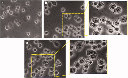 Figure 1. Phagocytosis of (RB-NPs)-GP by M. tuberculosis infected J774 cells. Representative images of (A) untreated M. tuberculosis infected J774 cells, (B) M. tuberculosis infected cells exposed to 10 μg/ml blank GP and (C) to 10 μg/ml (RB-NPs)-GP, with magnified view of respective regions within yellow panels.