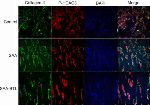 Figure 3 Immunofluorescence analysis of collagen II and P-HDAC 3 expression in fracture calluses at the 4th week post-surgery. P-HDAC3 and collagen II expression was quantified in sections of the callus. These data are shown in Figure 7A.