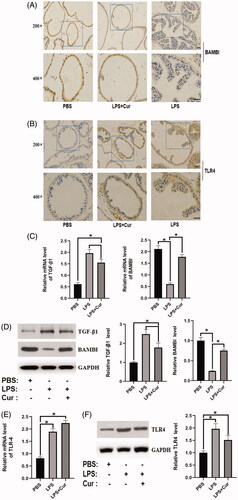 Figure 3. Effect of curcumin on the expression of BAMBI, TLR4, and TGF-β1 in the LPS-induced BPH mouse model (n = 8). (A) The expression of BAMBI in different groups, detected by immunohistochemistry (top panel: 200× magnification, bar = 50 μm; bottom panel: 400× magnification, bar = 50 μm). (B) The expression of TLR4 in various groups, as evidenced by immunohistochemistry (top panel: 200× magnification, bar = 50 μm; bottom panel: 400× magnification, bar = 50 μm). (C,D) mRNA and protein expression of BAMBI and TGF-β1 in each group, respectively (n = 8). (E,F) mRNA and protein expression level of TLR4 in each group. *p < 0.05.