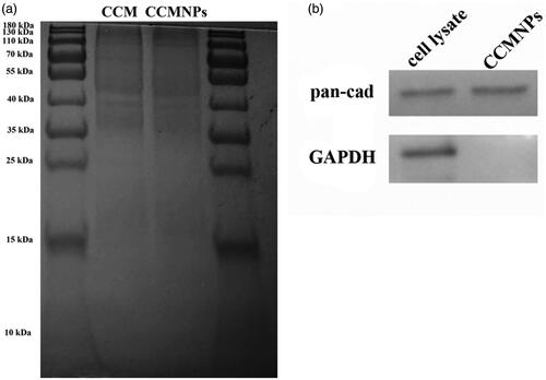 Figure 2. Membrane antigen characterization of CCMNPs. (a) SDS-PAGE protein analysis of cancer cell membrane vesicles and CCMNPs. Samples were run at equal protein concentration and stained with Coomassie Blue. (b) Western blotting analysis for membrane-specific protein, pan-cadherin.