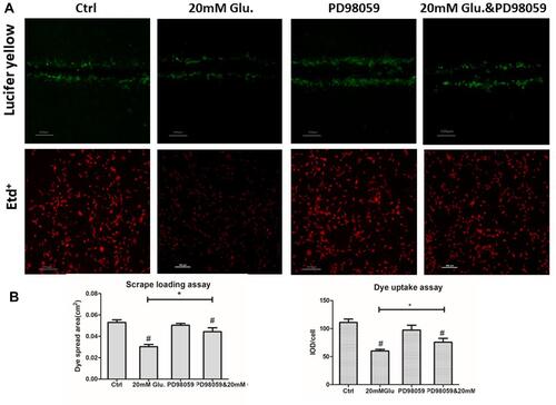 Figure 7 PD98059 reversed glucose-mediated downregulation of Cx43 gap junction and hemichannel function in MLO-Y4 cells. (A and B) Cx43 gap junction and hemichannel function were partially rescued by PD98059, as determined by scrape loading and uptake assays. Cx43 gap junction and hemichannel function levels were rescued by 46.35% and 26.05%, respectively, compared with those in cells treated with glucose only. *P<0.05 vs 20 mM Glu. #P<0.01 vs Ctrl. Data are presented as the mean ± standard deviation of three independent experiments.