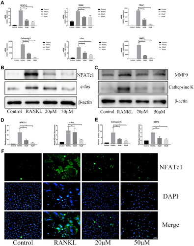 Figure 4 OB abrogates RANKL‐associated NFATc1and c-fos transcription and downregulates osteoclast-related genes. (A) The RT‐qPCR assay detected the relative mRNA expression of osteoclastogenesis-associated marker genes, including NFATc1, c-fos, TRAP, Rank, cathepsin K and MMP9. (B) Western-blot analysis for OB’s effects on protein levels of NFATc1 and c-fos. (C) Western-blot analysis for OB’s effects on protein levels of MMP9 and cathepsin K. (D) Quantitative analysis of NFATc1 and c-fos. (E) Quantitative analysis of MMP9 and cathepsin K. (F) Immunofluorescence images for OB’s effects on protein expression of NFATc1. ns, no statistical significance; *P < 0.05; **P < 0.01.