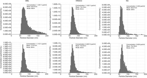 Fig. 3.  Sizing and counting of particles by qNano. Fractions #4 were isolated from plasma of 2 AML patients, 2 HNSCC patients and 2 NCs by mini-SEC and evaluated by qNano as described in Materials and Methods. AML=acute myeloid leukaemia; HNSCC=head and neck squamous cell carcinoma; NC=normal control.