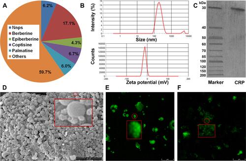 Figure 1 Characterization of the natural nanoparticles (Nnps) isolated from Coptidis Rhizoma extract; (A) Content of Nnps in Coptidis Rhizoma extract; (B) Size and Zeta potential of Nnps; (C) Purity and molecular weight of the protein molecules (CRP, Coptidis Rhizoma protein) forming Nnps; (D) Scanning electron microscope observation of Nnps powder (10,000 ×); (E) Observation of Nnps powder by laser confocal fluorescence microscopy (6000 ×); (F) Observation of the water solution of Nnps by laser confocal fluorescence microscopy (6000 ×). In Figure 1D, the large red rectangle showed an enlarged image of the Nnps contained in the small red rectangle. In Figure 1E and F, the red dotted rectangle showed an enlarged image of the Nnps contained in the small red dotted circle, respectively.