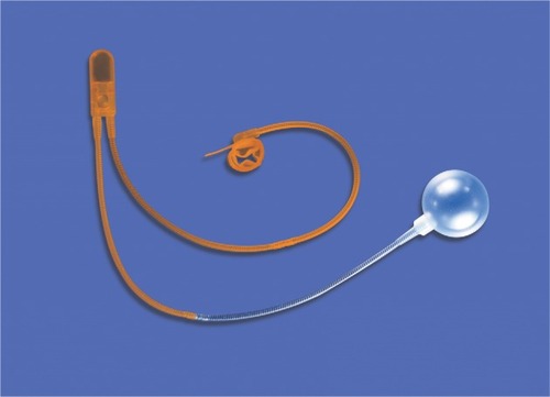 Figure 1 The AMS 800 (American Medical Systems, Minnetonka, MN, USA) artificial urinary sphincter developed in 1983, with the addition of the InhibiZone coating in 2007.