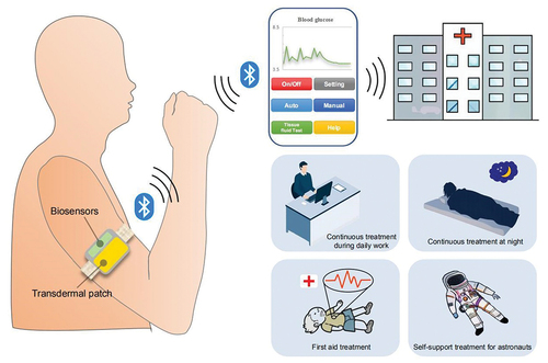 Figure 11. A vision of an intelligent wearable TDD device and its operation scenario.
