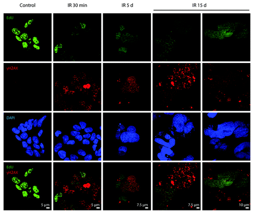 Figure 9. Analysis of colocalization of DDR foci with the sites of DNA replication. Non-irradiated and IR-exposed cells were subjected to EdU incorporation assay by “click-it” method and stained with antibodies against γH2AX. Confocal images are shown.