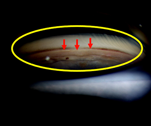 Figure 1 Gonioscopic view of a persistent opening (indicated by red arrows) on the goniotomy site (yellow outline).