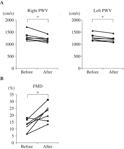 Figure 1. Glabridin improved vascular function in healthy volunteer.Seven healthy volunteers were assigned to receive an oral dose of glabridin (300 mg) once daily for 12 weeks. Brachial–ankle pulse wave velocity (baPWV) (a) and flow-mediated vasodilatation (FMD) (b) were examined before and after the treatment period. *p < 0.05.