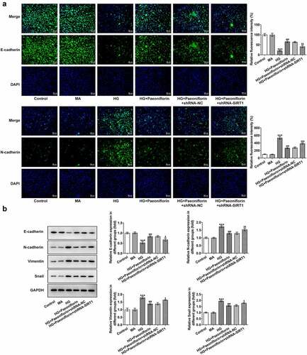 Figure 5. Down-regulation of SIRT1 reversed the protective effect of Pae on EMT in SRA01/04 cells induced by HG. a. IF detected the expression of E-cadherin and N-cadherin. b. Western blot detected the expression of EMT-related proteins. ***p < 0.001, ##p < 0.01, ###p < 0.001vs HG, $p < 0.05, $$p < 0.01, $$$p < 0.001 vs HG + Paeoniflorin + shRNA-NC.