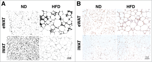 Figure 1. High fat diet induced obesity modifies the adipose tissue elastin matrix. Paraffin embedded sections were stained with (A) Verhoeff Van Gieson's elastin stain and (B) Immunohistochemical staining with anti-elastin antibodies. Samples were obtained from lean (ND) and obese (HFD) mouse epididymal (eWAT) and subcutaneous inguinal (iWAT) tissues. Representative images shown from one of 5 replicate samples with similar results. (scale bar = 100 μM).
