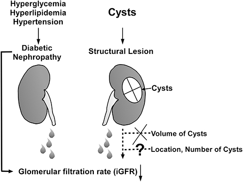 Figure 5 In T2DM patients, the reduced glomerular filtration rate (iGFR) may be caused by hyperglycemia, hypertension, and hyperlipidemia. The volume of renal cysts did not affect the unilateral kidney’s glomerular filtration rate. The remaining variables, such as cyst location and number, are unknown.