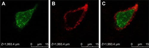 Figure 3 Laser confocal microscope images of Mcf-7 cells with MWNTs-Ge-Le-Rh.Notes: (A) Rhodamine 123, (B) cell membrane staining by CellMask Deep Red, (C) overlay. The nanotubes were found internalized and accumulated inside the cell about 3 h after incubation.Abbreviations: Mcf-7, Michigan cancer foundation-7; MWNTs-Ge-Le-Rh, multiwalled carbon nanotubes/gemcitabine/lentinan/rhodamine 123.