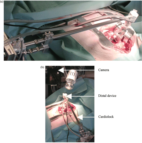 Figure 12. The Cardiolock device during an experimental validation. [Color version available online.]