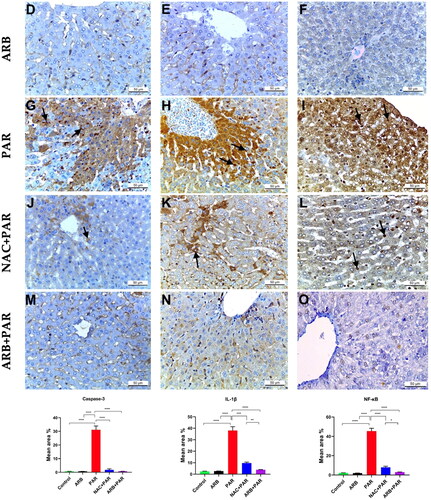 Figure 6. Immunohistochemical analysis of Caspase 3, IL-1B, and NF-KB in liver tissue from all study groups (magnification ×400, scale bar = 50 μm). (A-C) Control group; (D-F) ARB group; (G-I) PAR group; (J-L) NAC + PAR group; (M-O) ARB + PAR group. Control and ARB groups showed negative cytoplasmic expression of Caspase 3 and IL-1B (A,B,D,E) and negative nuclear expression of NF-KB (C,F). PAR group exhibited intense positive cytoplasmic Caspase 3 and IL-1B staining (arrows) (G,H respectively) and strong positive NF-KB nuclear expression (arrows) (I). NAC + PAR group showed mild Caspase 3 and moderate IL-1B cytoplasmic expression (arrow) (J,K respectively) and mild nuclear expression for NF-KB (arrow) (L). ARB + PAR group exhibited negative Caspase 3 and mild IL-1B cytoplasmic staining (M,N respectively) and negative nuclear expression for NF-KB (O). Data are represented as mean ± SD (n = 10) using one-way ANOVA followed by Tukey’s multiple comparison test at *P < 0.05, **P < 0.01, ***P < 0.001, ****P < 0.0001.