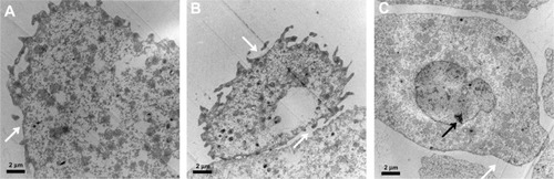 Figure 6 Transmission electron microscope images of the blastoderm cells of affected embryos loaded with BSA-MWCNTs (MWCNTs-48 h) at 6 hpf. The membranes of the enveloping cells were disrupted (A and B).The deep-layer cells detached and had irregular nuclei with condensed chromatins (C).Note: The white arrow points to corrupted membrane, and black arrow to irregular nucleus. Scale bar, 2 μm.Abbreviations: BSA-MWCNT, bovine serum albumin-functionalized multiwalled carbon nanotube; hpf, hours postfertilization.