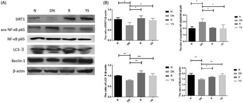 Figure 3. Effects of Yishen capsule on the expression of SIRT1, acetylated NF-κB p65, NF-κB p65, LC3-II, and Beclin-1 in the kidney of rats. (A) Representative western blotting images showing the expression of SIRT1, acetylated NF-κB p65, LC3-II, and Beclin-1; (B) Quantification of SIRT1, acetylated NF-κB p65, NF-κB p65, LC3-II, and Beclin-1 expression. Values are presented as the mean ± SD. n = 3. *p < 0.05; **p < 0.01; ***p < 0.001.