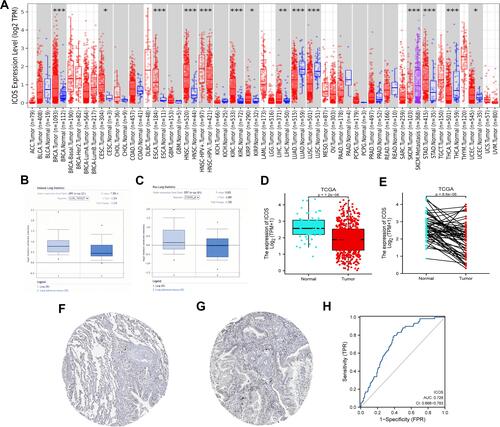 Figure 1 The expression level of ICOS in different types of tumor tissues and normal tissues (A) the expression level of ICOS in different types of tumor tissues and normal tissues in TIMER database. (B and C) Box plot showing ICOS mRNA expression in the Oncomine datasets. (D and E) Results of comparison of normal and LUAD tissues in the TCGA. (F and G) Comparison of ICOS expression between immunohistochemical images of normal and tumor tissues in HPA. (H) A ROC curve to test the value of ICOS to identify LUAD tissues was created. (*P < 0.05, **P < 0.01, ***P < 0.001).