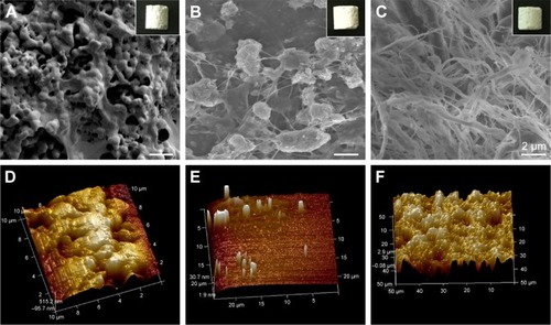 Figure 1 The macroscopic and surface topography images.Note: HA (A, D), EMC (B, E), and IMC (C, F) visualized by SEM and AFM, individually.Abbreviations: AFM, atomic force microscopy; EMC, extrafibrillar mineralized collagen; HA, nano-hydroxyapatite; IMC, intrafibrillar mineralized collagen; SEM, scanning electron microscopy.