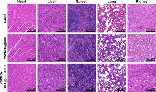 Figure 7 Representative H&E sections of organ tissues (heart, liver, spleen, lung, and kidney) of tumor-bearing BALB/c mice after different treatments.Abbreviations: H&E, hematoxylin and eosin; NIR, near infrared; YSPMOs, yolk–shell-structured periodic mesoporous organosilica nanoparticles.