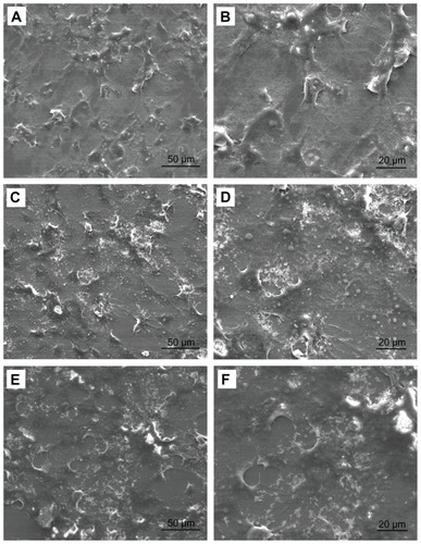 Figure 5 Field emission scanning electron microscopic images of MG-63 cells cocultured with different nanohydroxyapatite particles for 5 days: (A and B) as controls; (C and D) n-HA1; (E and F) n-HA2.Abbreviation: n-HA, nanohydroxyapatite.