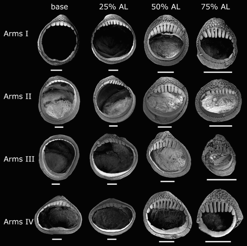 Figure 32 Mastigopsis hjorti arm suckers, NMNZ M.172921, ♀, ML 142* mm. Scale bars = 200 µm.