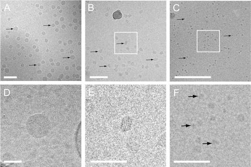 Fig. 3 Cryo-EM of freshly isolated lipoprotein fractions. Overviews (A–C) and higher magnification (D–F) images of VLDL (A and D), LDL (B and E) and HDL (C and F) fractions clearly show the different lipoprotein particles (denoted by black arrows). White squares in B and C denote magnified images in E and F. Also note the periodic layers of LDL in E. Scale bars are 100 nm (A and B) and 50 nm (C, D, E and F).