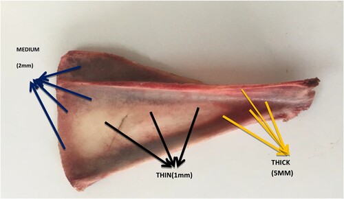 Figure 3. Thick-thin-medium portion on scapula bone.