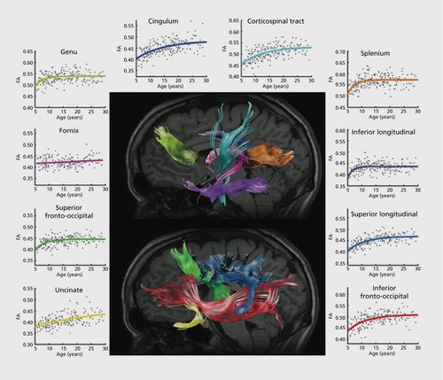 Figure 2. White matter maturation between ages 5 and 30. Age-related fractional anisotropy increases measured by tractography in 202 individuals across 10 tracts. Reproduced from ref 48: Lebel C, Walker L, Leemans A, Phillips L, Beaulieu C. Microstructural maturation of the human brain from childhood to adulthood. Neurolmage. 2008;40:1044-1055. Copyright © Elsevier 2008