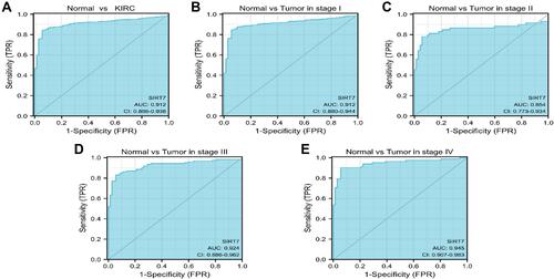 Figure 5 Assessment of the utility of SIRT7 as a diagnostic biomarker for KIRC. (A) ROC curves indicated that SIRT7 expression was an effective means of differentiating between KIRC tumors and non-tumor tissues. The X- and Y-axis correspond to rates of true- and false-positive results, respectively. (B–E) Subgroup analyses for stage I, II, III, and IV KIRC tumors.