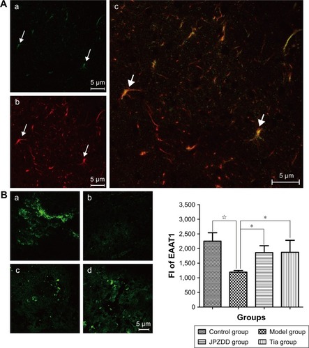 Figure 5 The expression of EAAT1 as determined by LSCM.