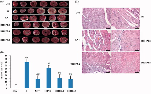 Figure 2. Myocardial pathology and myocardial infarct size in every groups. (A) Photos of myocardium with TTC staining. (B) Myocardial infarct size (%). (C) Representative photos of myocardium stained with HE (200×). Data were expressed as the mean ± SD (n = 6). **p < 0.01 vs. Con; *p < 0.05 vs. Con; ##p < 0.01 vs. IR #p < 0.05 vs. IR.