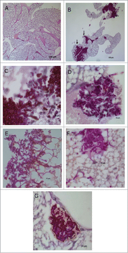 Figure 8. Histological sections of the fat body of Galleria mellonella.(A) Normal appearance of the fat body of G. mellonella not infected with Candida albicans. (B) C. albicans and PBS control group: observe the presence of clusters of hyphae and yeast cells (arrow). PAS; original magnification: 100×. (C) C. albicans and MRS control group. (D) C. albicans + L. acidophilus culture filtrate group. (E) C. albicans and PBS control group. (F) C. albicans + L. acidophilus cells group. (G) C. albicans + L. acidophilus cells group: with demarcation taken by Image J program for obtaining occupied by hyphae and yeasts area. PAS; original magnification: 1000×.