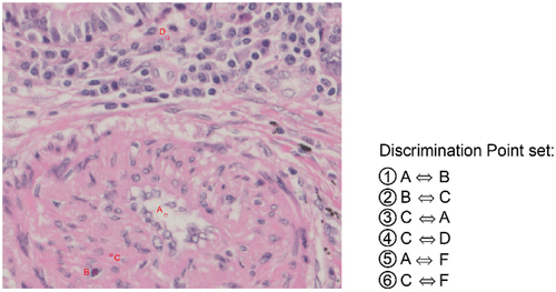 Figure 7. Example of a discrimination point set for a small artery feature.