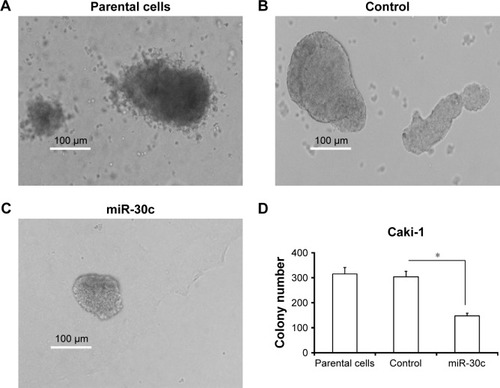 Figure 4 miR-30c inhibits anchorage-independent growth of Caki-1 cells.