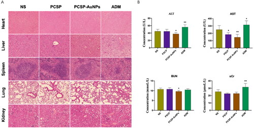 Figure 9. Toxicity tests. (A) H&E staining of the heart, liver, spleen, lung, and kidney. (B) The blood biochemical analysis for ALT, AST, Bun and sCr. *p < 0.05, **p < 0.01, compared to the control group.