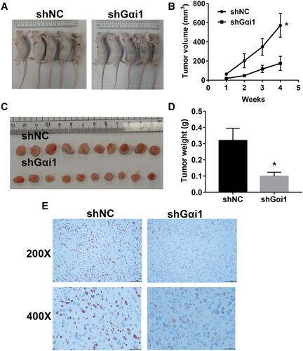 Figure 7 Gαi1 knockdown inhibited tumor growth in nude mice. Subcutaneous tumor model of 786-O cells with Gαi1 knockdown. (A) Gαi1 knockdown led to decreased tumor volume. (B) The photos of tumors derived from shNC and shGαi1 cells in nude mice. (C and D) The changes in volume weight were measured at the indicated weeks after mice were transplanted. (E) IHC analysis that Gαi1 knockdown reduced Ki67 protein expression. Results were presented as mean ± SD. *P<0.05.