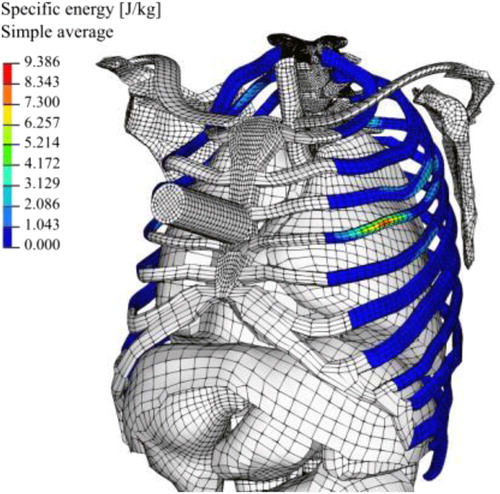 Figure 1. Human torso model and specific energy field of the cortical ribs in the direction anteroposterior.