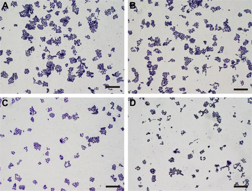 Figure S6 Inhibition of the formation of cell colony by p53 transfection mediated by different carriers: (A) control; (B) AP-PAMAM; (C) PAMAM/p53; and (D) AP-PAMAM/p53.Note: The scale bar is 400 μm.Abbreviations: AP-PAMAM, 2-amino-6-chloropurine-modified PAMAM; PAMAM, polyamidoamine.