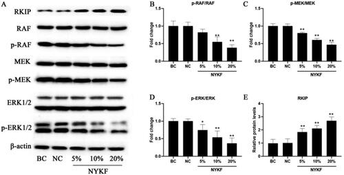 Figure 6. NYKF treatments regulate RAF/MEK/ERK signaling pathway in hEM15A cells. hEM15A cells were cultured with 5%, 10%, 20% NYKF-medicated mice serum, mice serum without NYKF (NC), or without mice serum (BC). A: The image of western bolt band. The ratio of p-RAF/RAF (B), p-MEK/MEK (C), p-ERK/ERK (D), and relative protein expression of RKIP (E) were measured by western blotting. Data are shown as means ± SD (n = 3), and data between multiple groups were compared by one-way ANOVA. *p < .01, **p < .01 compared with NC group.