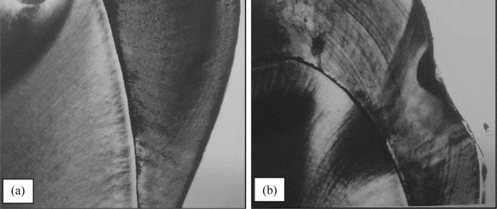 FIGURE 2 A typical microscopic evaluation of sectioned teeth (10 ×): (a) sound proximal surface; (b) carious proximal surface.